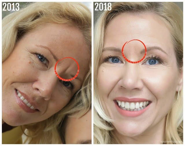 Dermaflage before and after