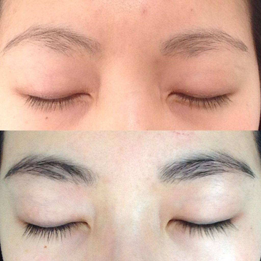 neulash before and after