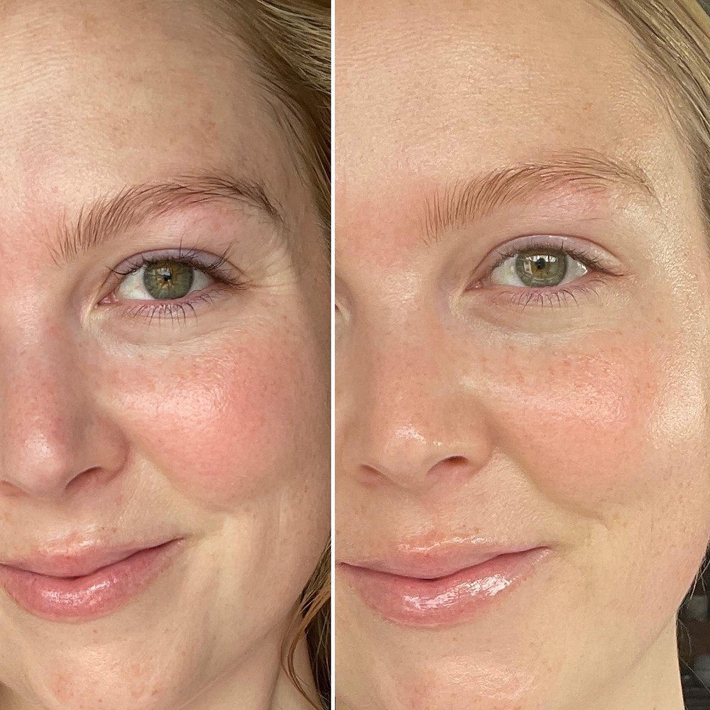 SkinCeuticals Vitamin C serum before and after